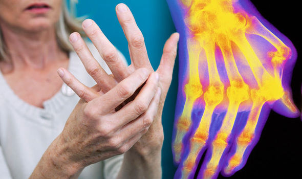 Stem Cell Therapy Treatment for Rheumatoid Arthritis cost in India